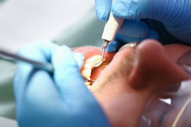Best Lost Filling or Crown Replacement in Tickfaw, LA